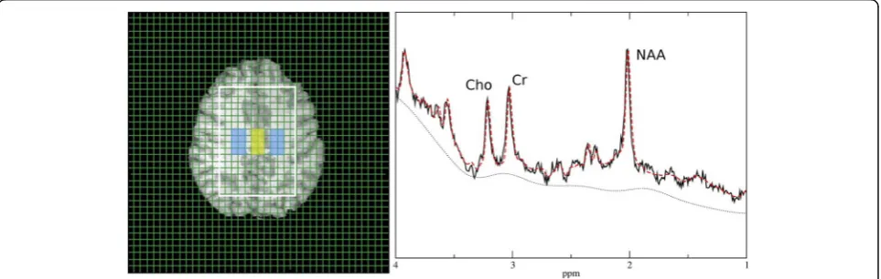 Fig. 1 Target region and representative 1H spectrum from a GM voxel of the target yellow marked target region
