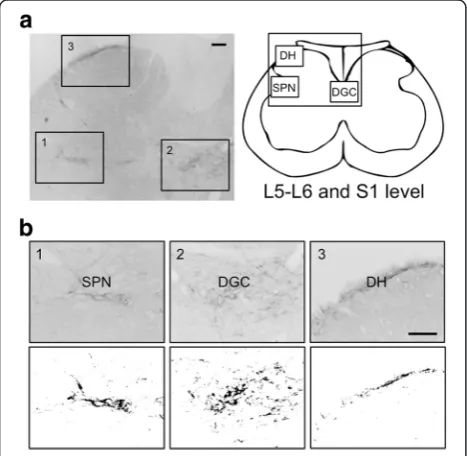 Fig. 1 Semi-quantitative analysis of the expression of gastrin-releasingparasympathetic nucleus (SPN, a1), dorsal gray commissure (DGC, a2),and dorsal horn (DH, a3)