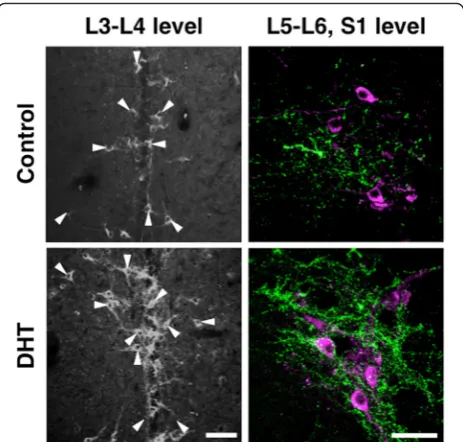 Fig. 6 Masculinization of the spinal GRP system in female neonatesincreased intensity of GRP-immunoreactive fibers in the SPN inducedby neonatal administration of DHT.GRP-positive cell bodies