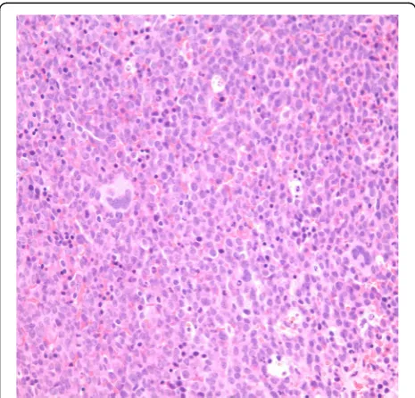 Fig. 4 H&E stain of the patient's bone marrow biopsy consistentwith AML-M5 under 40x magnification