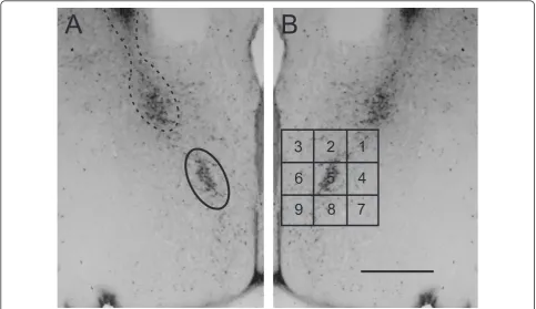 Figure 1 Ellipse and grid contours designed to quantify calbindin-immunoreactive (ir) cell number in and surrounding the calbindin-irsexually dimorphic nucleus in the preoptic area (CALB-SDN)
