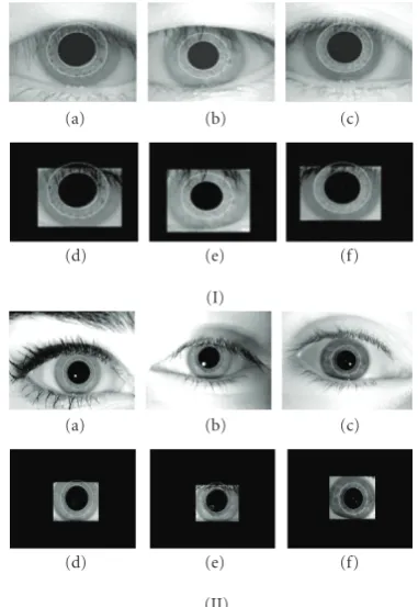 Figure 4: (a) Circle around the pupil indicates the collarette region. (b) Collarette area is occluded by the eyelashes and the upper eyelid.