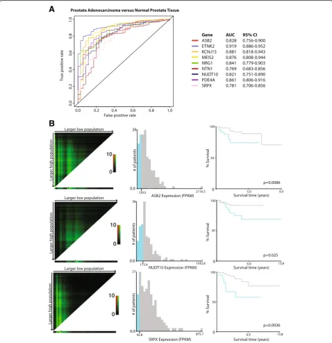 Fig. 4 Candidate gene expression is indicative of tumor status and can predict worse recurrence-free survival in patients.characteristic (ROC) curves for individual candidate gene expression, stratifying between benign ( a Receiver operatingn = 35) and tum