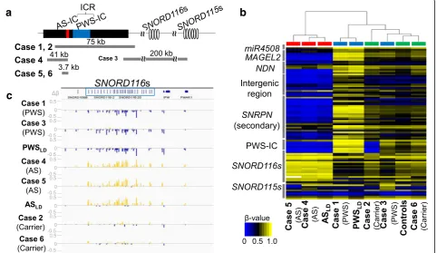 Fig. 2 Genomic organization of the PWS/AS locus and alteration in DNA methylation of CpG sites in 15q11boxes, those with PWS phenotype in blue boxes, and the carriers and normal controls in green boxes
