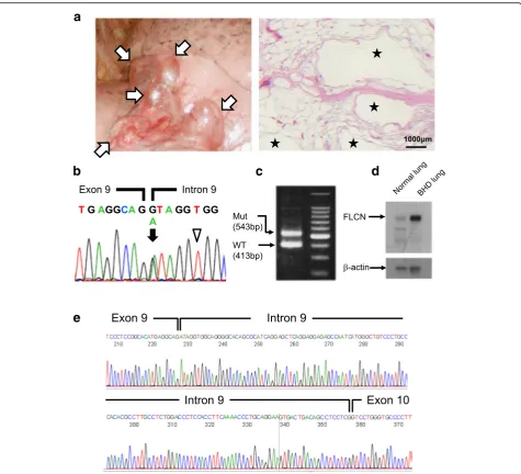 Fig. 2 Lung histology and FLCN analysis. (a) Left: The thoracoscopy revealed multiple subpleural cysts (arrows)