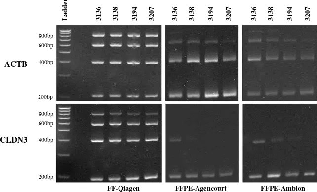 Figure 2ovarian adenocarcinoma samples 3136, 3138, 3194, and 3207RT-PCR amplification of different fragment sizes (200, 400, 600 and 800 bp) of ACTB and CLDN3 genes in FF and matched FFPE RT-PCR amplification of different fragment sizes (200, 400, 600 and 