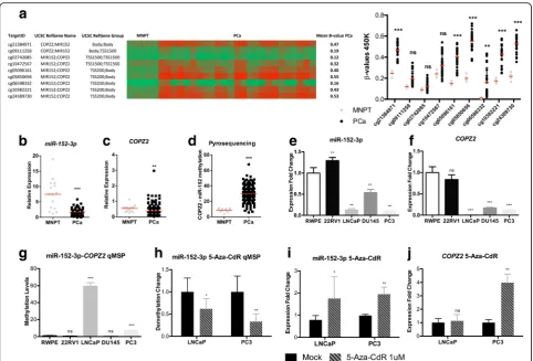 Fig. 2 COPZ2compared to RWPE (E 1).-miR-152-3p transcriptional unit’s DNA methylation and expression validation in IPO Porto’s cohort of prostate samples