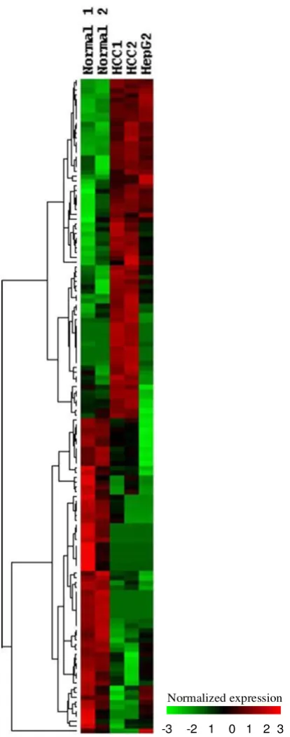 Figure 2HCCHierarchical clustering for genes differentially expressed in Hierarchical clustering for genes differentially expressed in HCC