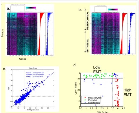 Figure 1 Intrinsic molecular stratification of human colorectal cancerexpression data derived from colorectal cancer cases identified 2 major