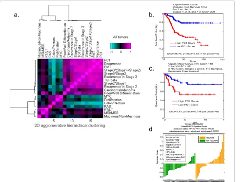 Figure 4 Covariance matrix showing correlation of PC1 with disease recurrence. (a) PC1, despite being developed with unsupervisedapproaches, appeared to correlate well with EMT, disease recurrence, disease progression, and differentiation status, but not w