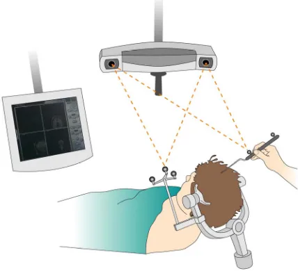 Figure 1. Drawing of an armless neuronavigation system setup. 