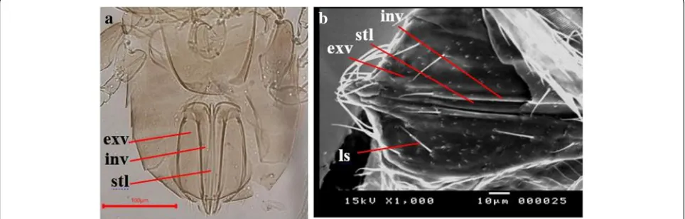 Fig. 7 SEM female abdomen metasoma lateral view (ter tergite)