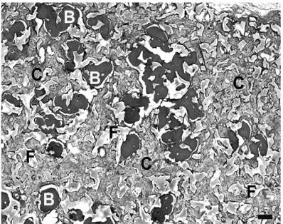 Figure 4. sponge without immersion in dextran solution before implantation. There was no apparent bone in the sponge