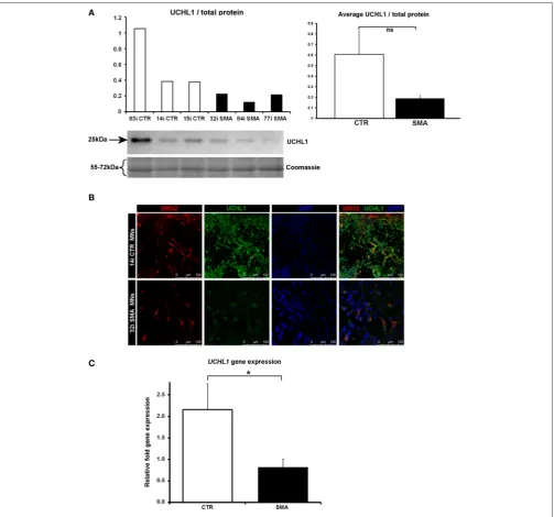 FIGURE 5 | Decreased UCHL1 levels in SMA motor neurons. (A) Representative western blot showing UCHL1 protein levels in three different control and SMA