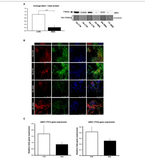 FIGURE 6 | Reduction and differential localization of UBA1 in SMA motor neurons. (A) Representative western blot showing UBA1 protein levels in threeexpression was normalized to H9 hESCs