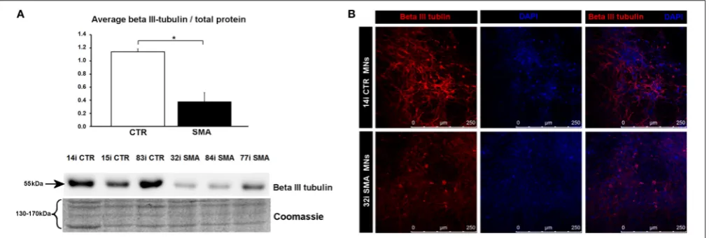 FIGURE 4 | Reduction of beta III-tubulin levels in SMA motor neurons. (A) Representative western blot showing beta III-tubulin protein levels in three differentcontrol and SMA motor neuron cell lines, along with Coomassie stained gel as loading control
