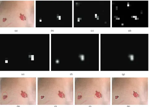 Figure 3. (a) Input image; (b) conspicuity map for color contrast; (c) conspicuity map for intensity contrast; (d) conspicuity map for orientation contrast; (e) saliency map combined by conspicuity maps; (f) WTA map for the attended location; (g) attended location; (h) active contours based on the attended location  