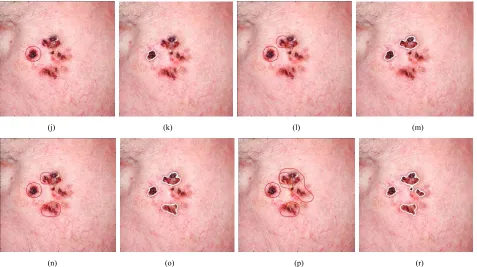 Figure 6. (a) Input image; (b) conspicuity map for color contrast; (c) conspicuity map for intensity contrast; (d) conspicuity map for orientation contrast; (e) saliency map combined by conspicuity maps; (f-i) WTA maps for the first, second, third and spectively; (k, m, o, r) active contours based first fourth attended locations, respectivelyfourth attended locations, respectively; (j, l, n, p) WTA maps for the first, second, third and fourth attended locations, re-  