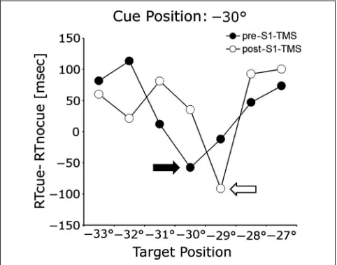 Figure 2. Cueing error in one example participant with a somatosensorycue at −30° from orbit midline, before and after S1EYE-cTBS