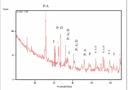 Figure 2. XRD spectrum of typical slag showing Anatase (A), Pesudobrookite (P), Iron phases (D)