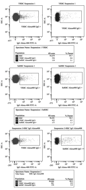 Figure 2. IgG+ RBCs in populations separated by Percoll gradients and populations analysed by light scattering parameters (FSC and SSC)
