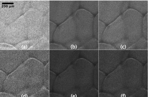 Fig. 6. Parallel illumination of the foam phantom with varying detection optics and colours