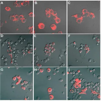 Figure 3. The relative red fluorescence intensity of macrophages treated with PA and/or treated with vehicle (Control), 75 μM PA alone or 75 μM PA together with 5 μg/ml CBD CBD
