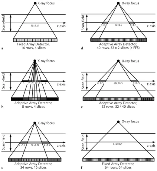 Fig. 3.10a–f. Examples of ﬁ xed array detectors and adaptive array detectors used in commercially  available multi-slice CT systems