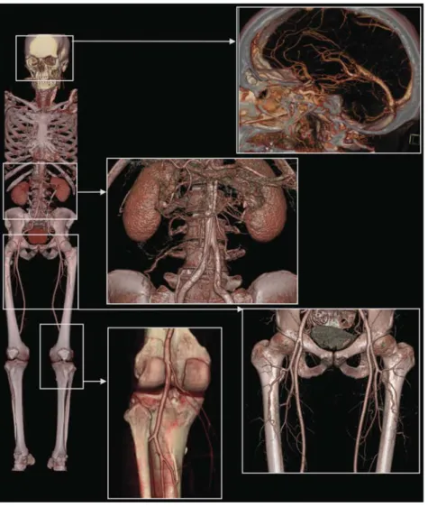 Fig. 3.5. Example of a whole-body CT angiography examination using a 64-slice CT with  z-ﬂ ying focal spot