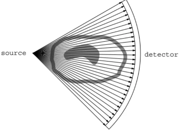 Figure 1.3. (Left) traditional x-ray. (Right) Tomographic reconstruction of a brain section