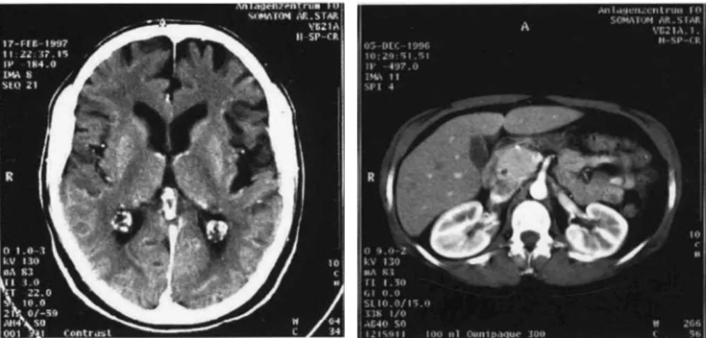 Figure 1.4. CT images. The left image is a cross section of a human brain. The right image is a cross section of a human abdomen