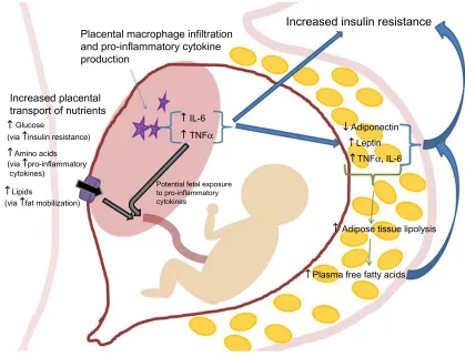 Figure 1 Placental and adipose tissue physiology in obese pregnancy. Notes: Macrophage infiltration of the placenta is thought to contribute to increased production of pro-inflammatory cytokines (TNF-α and iL-6)