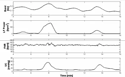 Figure 3. Example of FHRV spectral modifications. From the top, frequency content, evaluated by means of the Modified Crossing Threshold Method, power of the LF band, and CTG signal of the subject #18