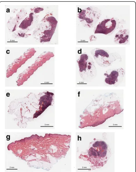 Fig. 2 H&E stained 5 μm cut sections from formalin fixed paraffinembedded (FFPE) melanoma