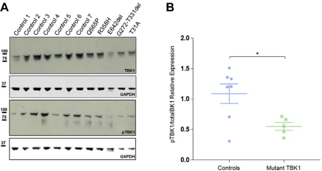 Fig. 4. Patient-derived LCLs harboringlymphoblastoid cell line; TBK1, tank binding kinase 1