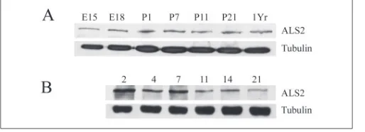 FIGURE 2. ALS2 stimulates PAK1 activity.Rac1 ( PAK1 in vitro kinase assays were performedwith CHO cells co-transfected with PAK1, Rac1, and ALS2, ALS2�DH, or vector pCIne-oCAT (CAT)