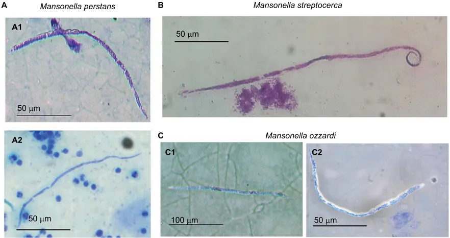 Figure 3 Comparison of the three agents causing mansonellosis illustrating the morphological characteristic of each microfilariae.São Gabriel da Cachoeira (Amazonas state, Brazil) (A1); African Notes: (A) M