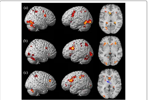Fig. 2 Brain activation maps superimposed onto stereotactically normalized T1-weighted image during three kinds of memory tests (p < 0.001,extent threshold k = 5)