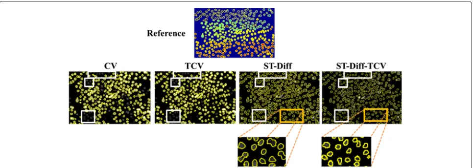 Fig. 9 Cell boundaries produced by the 4 tested methods on N2DL-HeLa02 sequence frame