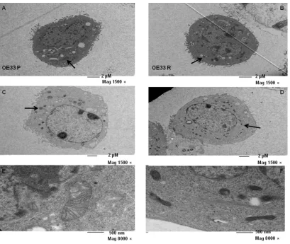 Figure 2. OE33 R cells have increased basal numbers of mitochondria and display altered morphology