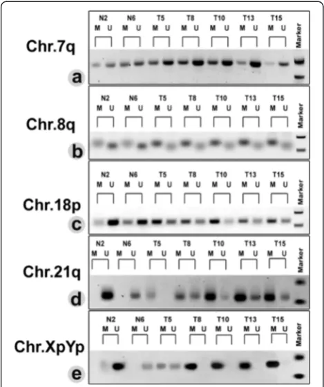 Fig. 1 A representative result of methylation specific PCR (MSP) inthe subtelomeric region on Chr