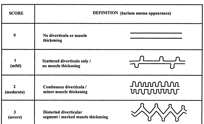 FIGURE 5.188Radiological classification of diverticular disease severity
