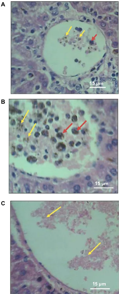 Figure 1 H&E stained liver sections showing profiles of central veins of (A) infected mouse given cocoa and (B) infected mouse not given cocoa containing parasitized RBCs (yellow arrows) and phagocytosed parasitized RBCs (red arrows)