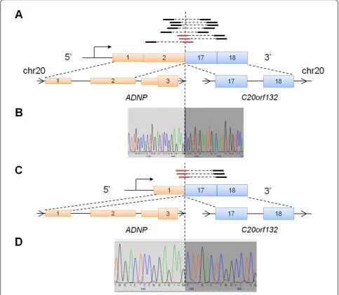 Figure 3 RNA-Seq and Sanger sequencing of ADNP-C20orf132. We identified another in-frame gene fusion in a primary tumor that waspresent as two transcript isoforms: (A) schematic of the first predicted gene fusion isoform illustrating RNA-Seq evidence that 