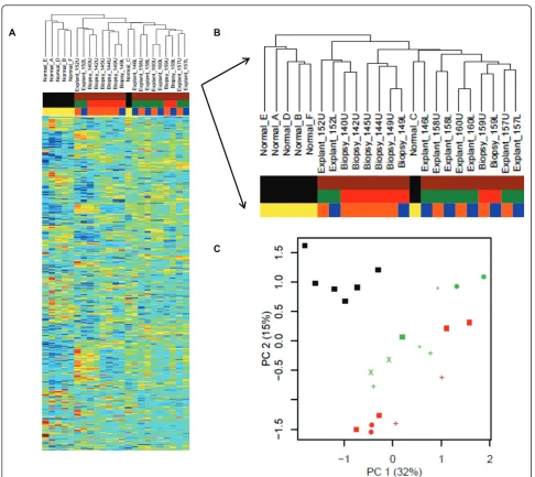 Figure 1 Unsupervised cluster of the complete dataset (training cohort). Samples include normal lung (black) and IPF (brown)