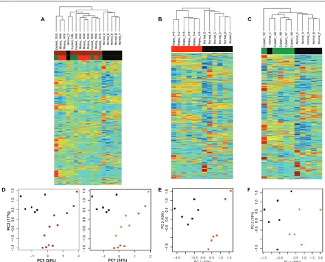 Figure 4 The training setstwo Principal Components.of 11 IPF samples (6 biopsies and 5 explants) and 6 normals.Unsupervised hierarchical clustering of 5 IPF explants samples and 6 normals.according to expression of the first two Principal Components