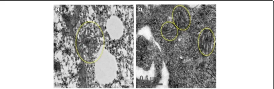 Fig. 1 Striking difference between mitochondria of Human MSCs and JEG-3 Cell Line as observed under Transmission Electron Microscope (TECNAIin number and peri-nuclear in localization