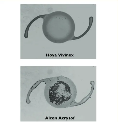 Figure 5. Extent of cell growth on the anterior IOL surface of Vivinex versus AcrySof.