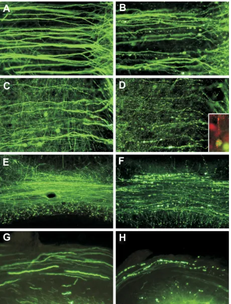 Figure 1 Fluorescence microscopy showing dendrites (a minority of dendrites (A and B) and axons (C and D) of layer v pyramidal neurons in the cerebral cortex of mock-infected (A and C) and moribund challenge virus standard-infected (B, D, and D inset) yell