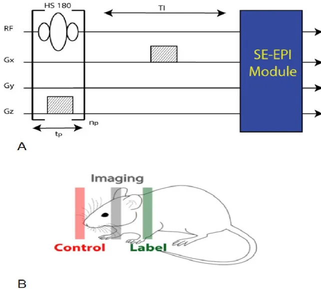 Figure 2.31: Example of perfusion weighted image using mbASL after subtracting label from  control image